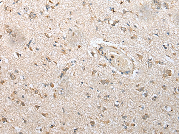 NUDT14 Antibody in Immunohistochemistry (Paraffin) (IHC (P))