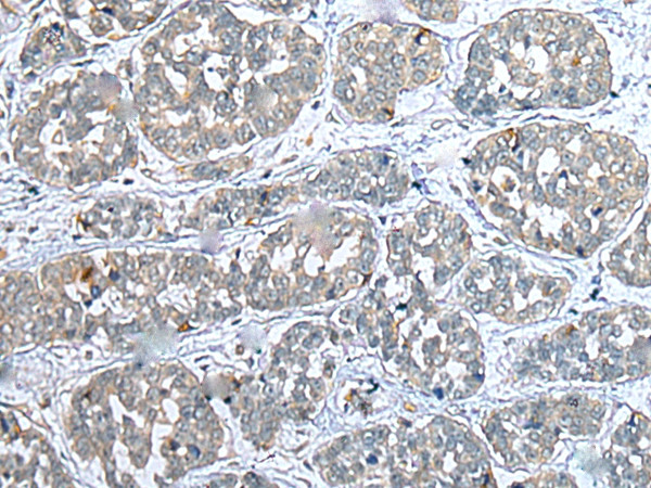 COMMD10 Antibody in Immunohistochemistry (Paraffin) (IHC (P))
