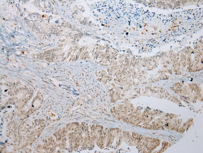 ING5 Antibody in Immunohistochemistry (Paraffin) (IHC (P))