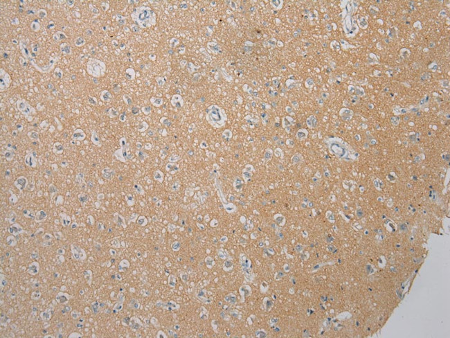 FOXN2 Antibody in Immunohistochemistry (Paraffin) (IHC (P))