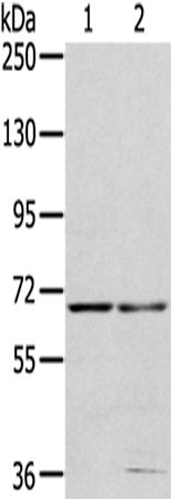 MMP24 Antibody in Western Blot (WB)