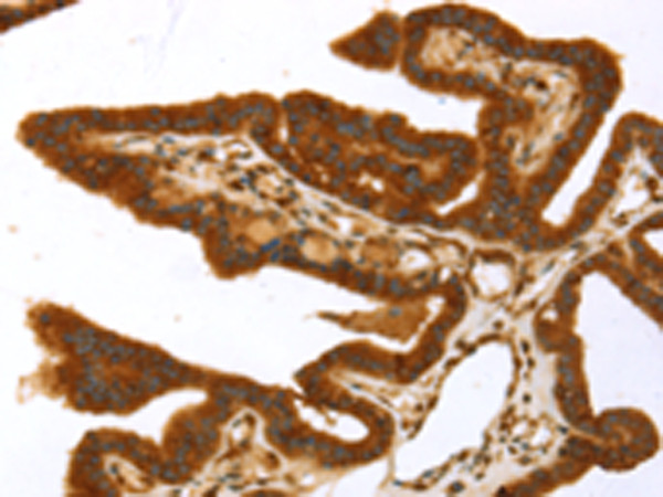 TP53I11 Antibody in Immunohistochemistry (Paraffin) (IHC (P))