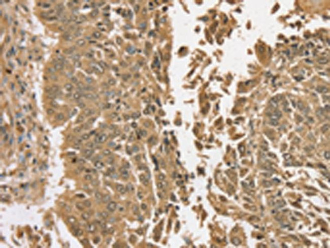TGM6 Antibody in Immunohistochemistry (Paraffin) (IHC (P))