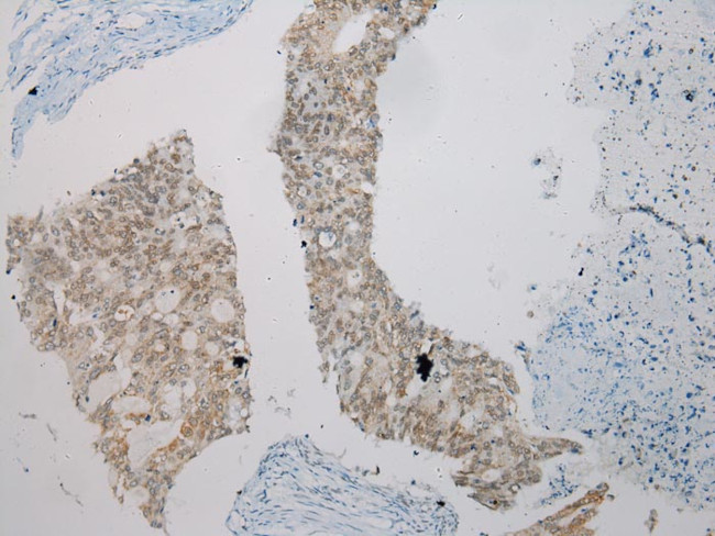 SMYD2 Antibody in Immunohistochemistry (Paraffin) (IHC (P))