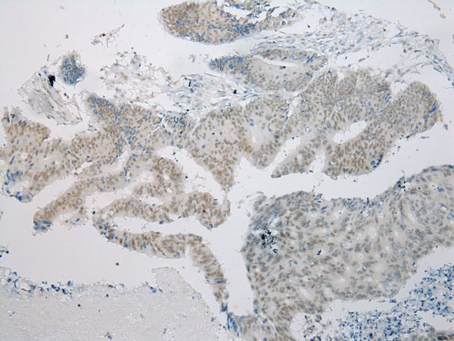 ARFGAP2 Antibody in Immunohistochemistry (Paraffin) (IHC (P))