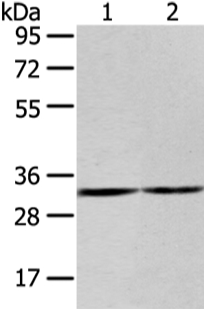 ZNF146 Antibody in Western Blot (WB)