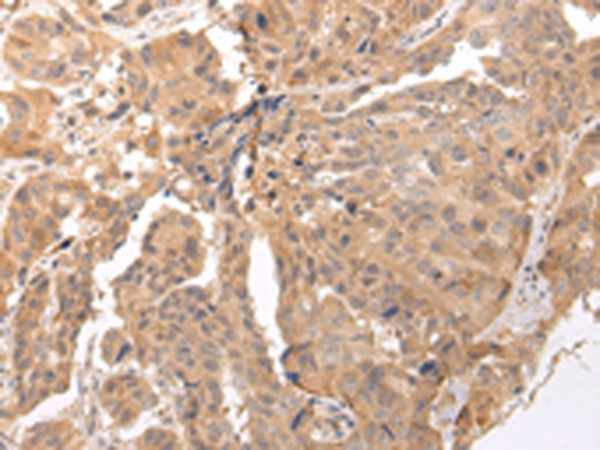 CLDND2 Antibody in Immunohistochemistry (Paraffin) (IHC (P))