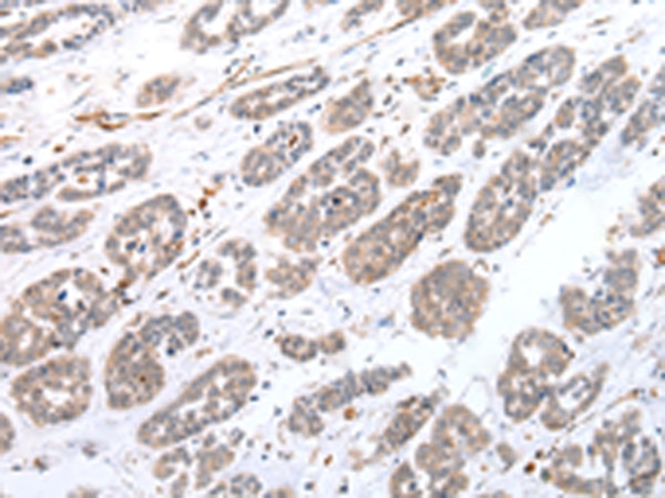 CPT1C Antibody in Immunohistochemistry (Paraffin) (IHC (P))