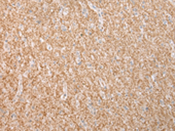 Dysferlin Antibody in Immunohistochemistry (Paraffin) (IHC (P))
