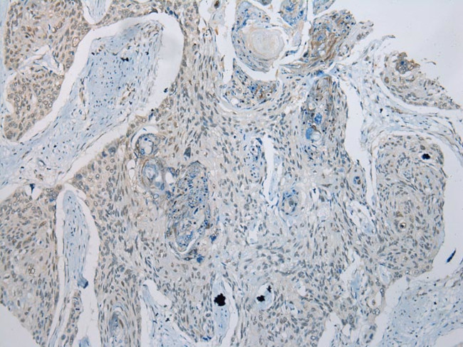 GDF10 Antibody in Immunohistochemistry (Paraffin) (IHC (P))