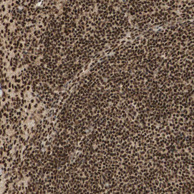 RNF113A Antibody in Immunohistochemistry (Paraffin) (IHC (P))