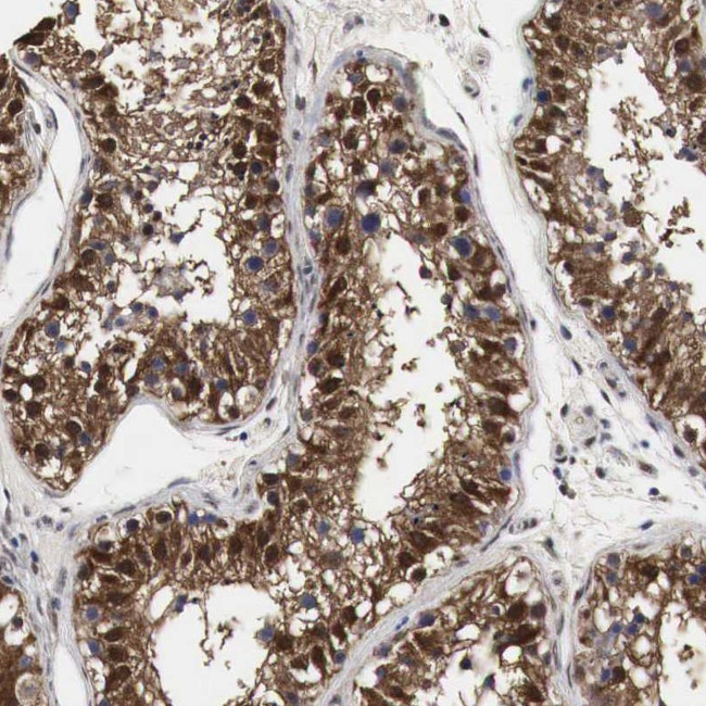 SPIN2 Antibody in Immunohistochemistry (Paraffin) (IHC (P))