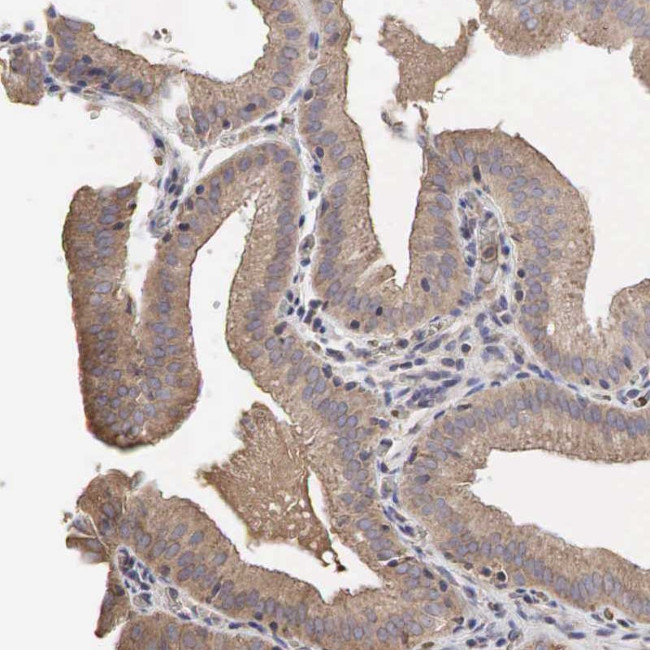 PABPC5 Antibody in Immunohistochemistry (Paraffin) (IHC (P))