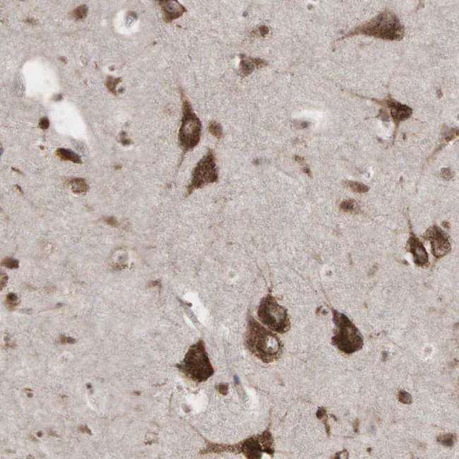 PABPC5 Antibody in Immunohistochemistry (Paraffin) (IHC (P))