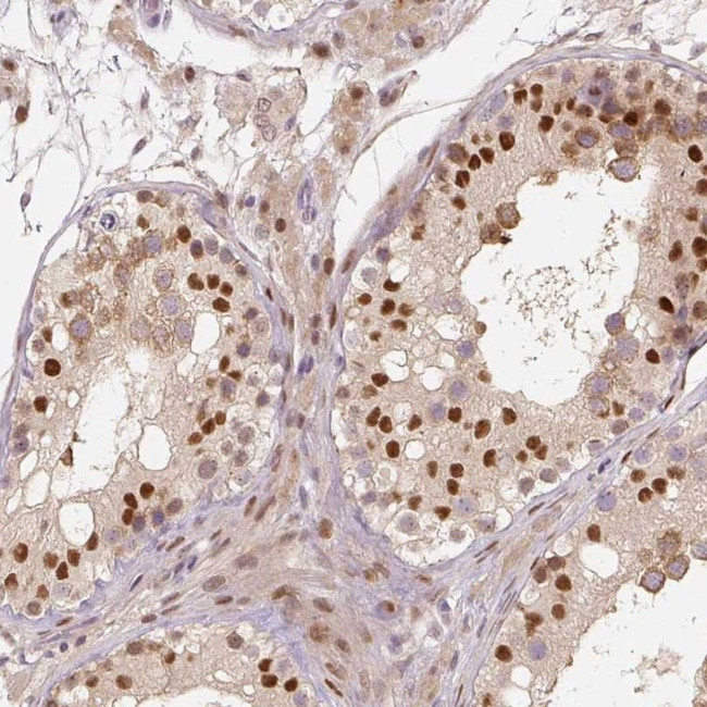 MUM1L1 Antibody in Immunohistochemistry (IHC)