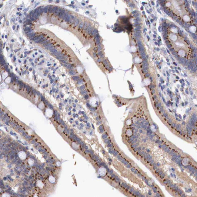 SYAP1 Antibody in Immunohistochemistry (Paraffin) (IHC (P))