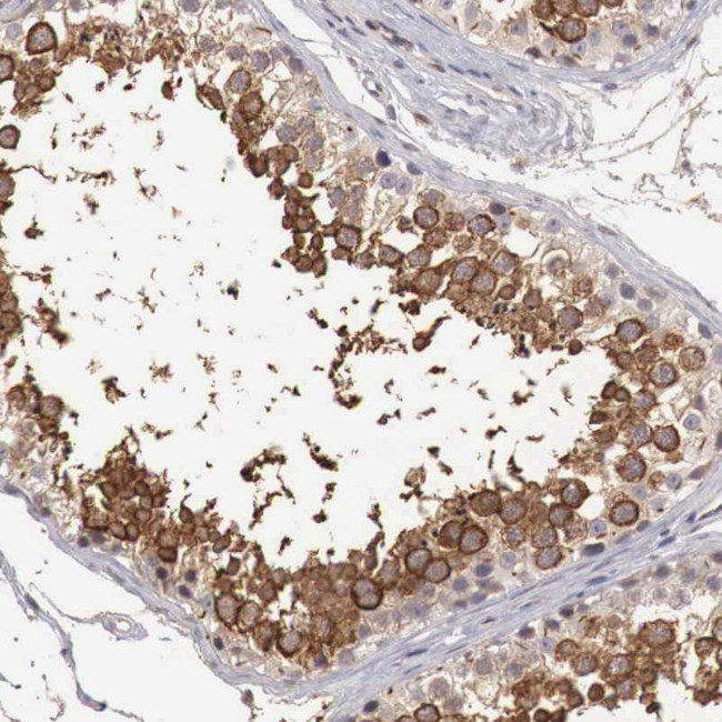 TBC1D9 Antibody in Immunohistochemistry (Paraffin) (IHC (P))