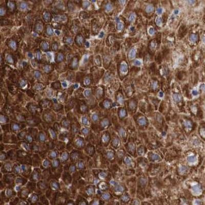 CKAP4 Antibody in Immunohistochemistry (Paraffin) (IHC (P))