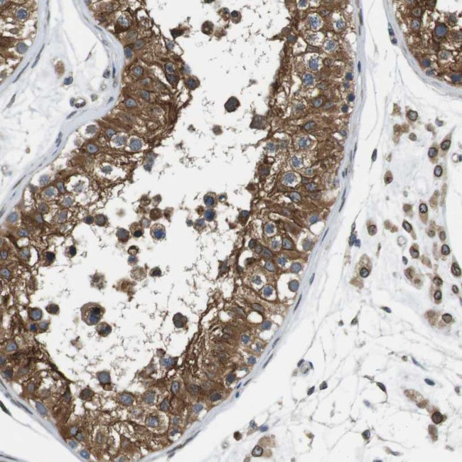 TMX4 Antibody in Immunohistochemistry (Paraffin) (IHC (P))