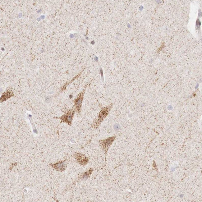 CLC-5 Antibody in Immunohistochemistry (Paraffin) (IHC (P))