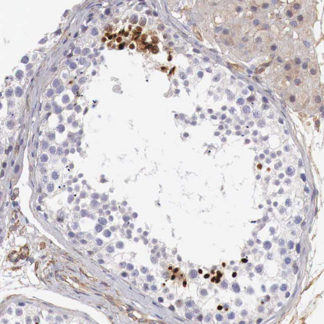 KIAA2022 Antibody in Immunohistochemistry (Paraffin) (IHC (P))