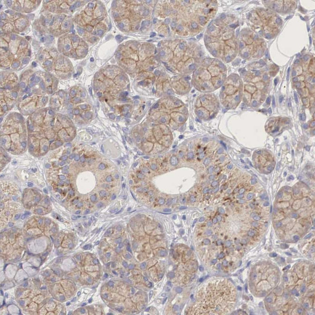 PCDH11X Antibody in Immunohistochemistry (Paraffin) (IHC (P))