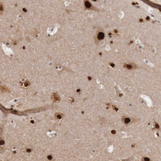 KHDRBS3 Antibody in Immunohistochemistry (Paraffin) (IHC (P))