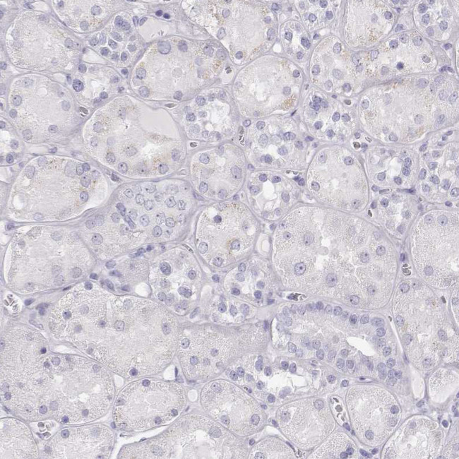 TKTL1 Antibody in Immunohistochemistry (Paraffin) (IHC (P))