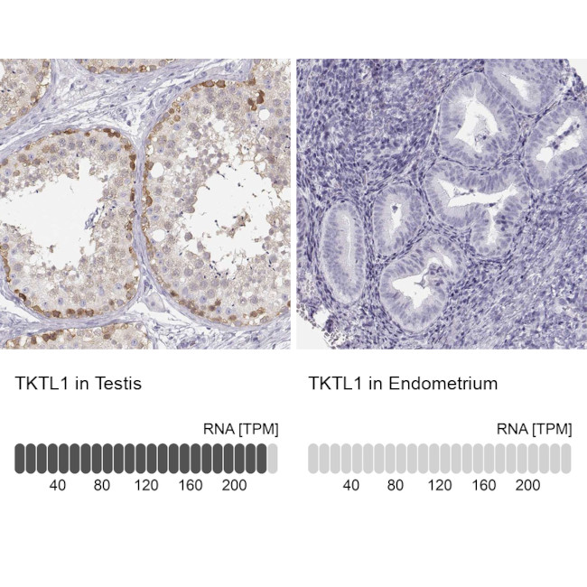 TKTL1 Polyclonal Antibody PA5 51394 tktl1-polyclonal-antibody-pa5-51394