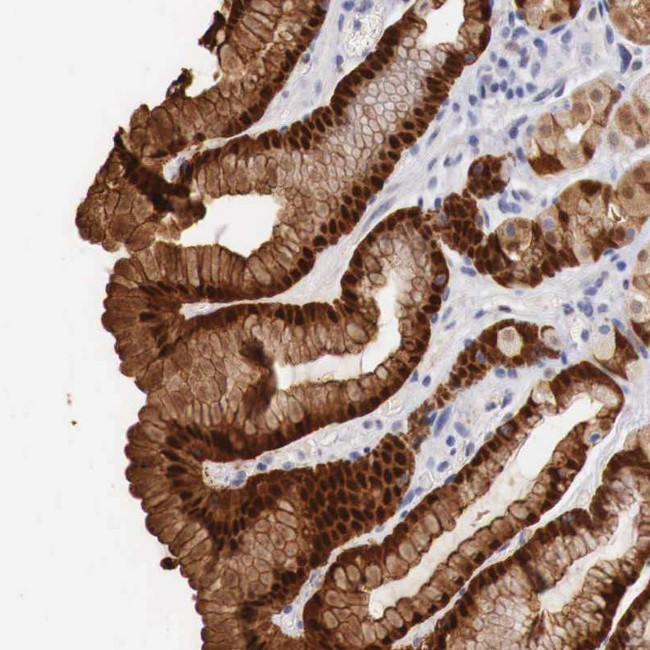 ITIH6 Antibody in Immunohistochemistry (Paraffin) (IHC (P))