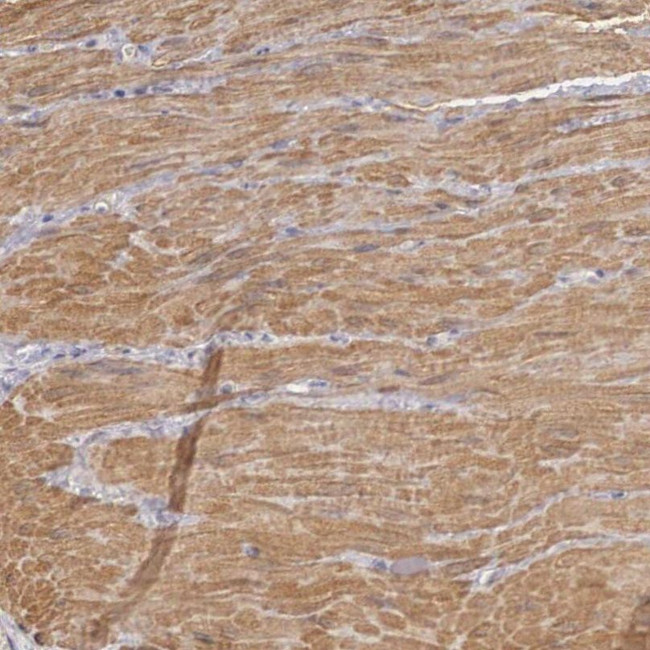ENOX2 Antibody in Immunohistochemistry (IHC)