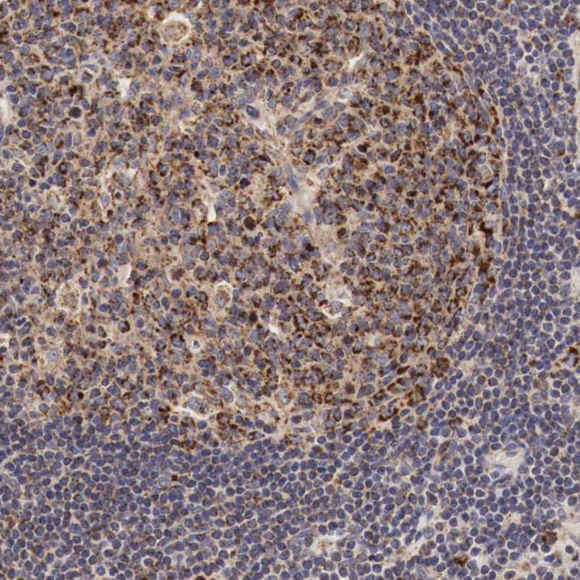 XPNPEP3 Antibody in Immunohistochemistry (Paraffin) (IHC (P))