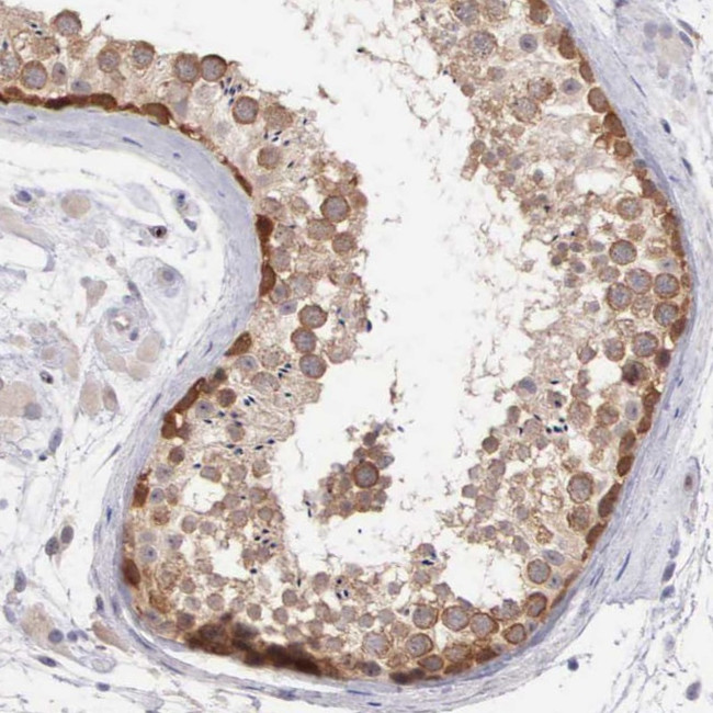 DNAJB7 Antibody in Immunohistochemistry (Paraffin) (IHC (P))