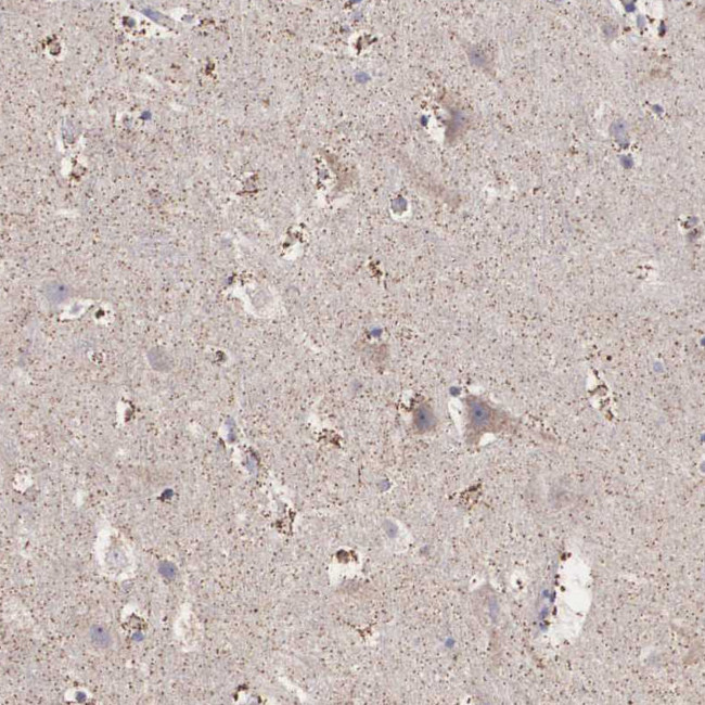 NREP Antibody in Immunohistochemistry (Paraffin) (IHC (P))