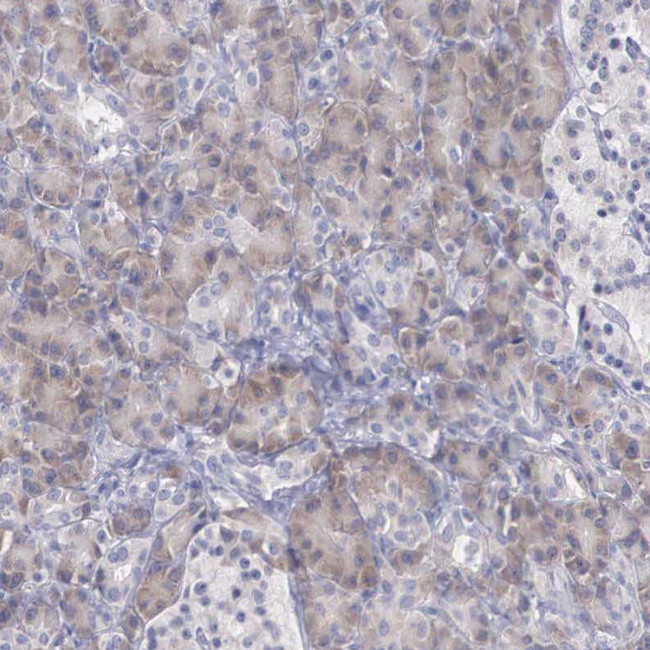 REPS2 Antibody in Immunohistochemistry (Paraffin) (IHC (P))