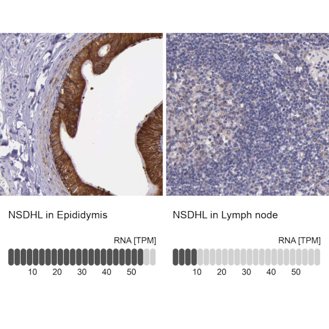 NSDHL Antibody in Immunohistochemistry (IHC)