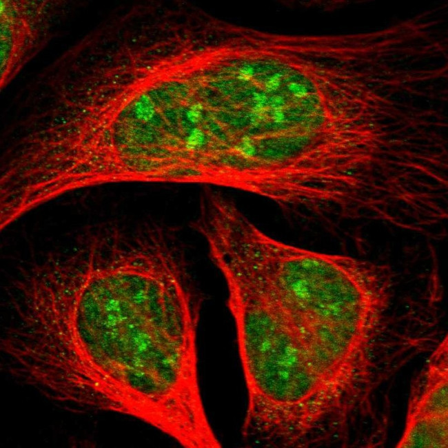 PJA Antibody in Immunocytochemistry (ICC/IF)