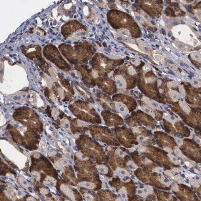 CRELD2 Antibody in Immunohistochemistry (Paraffin) (IHC (P))