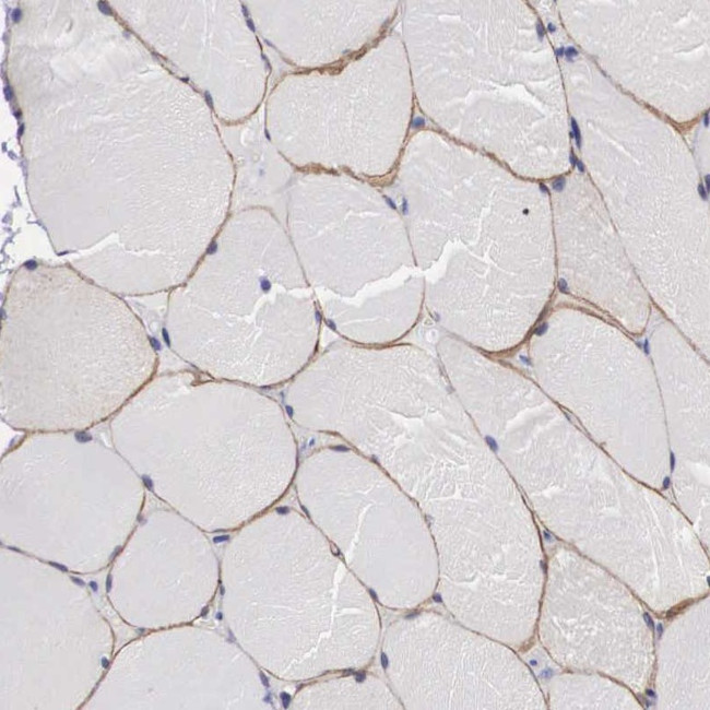 C22orf31 Antibody in Immunohistochemistry (Paraffin) (IHC (P))