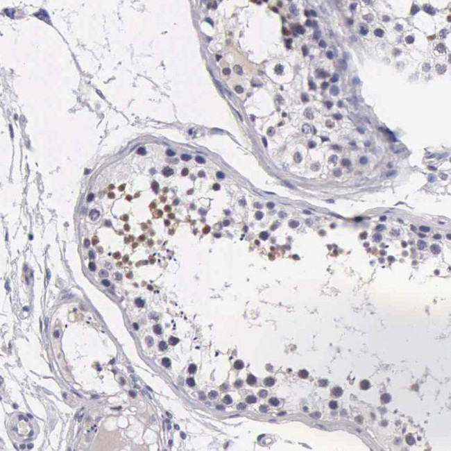 FAM47A Antibody in Immunohistochemistry (Paraffin) (IHC (P))