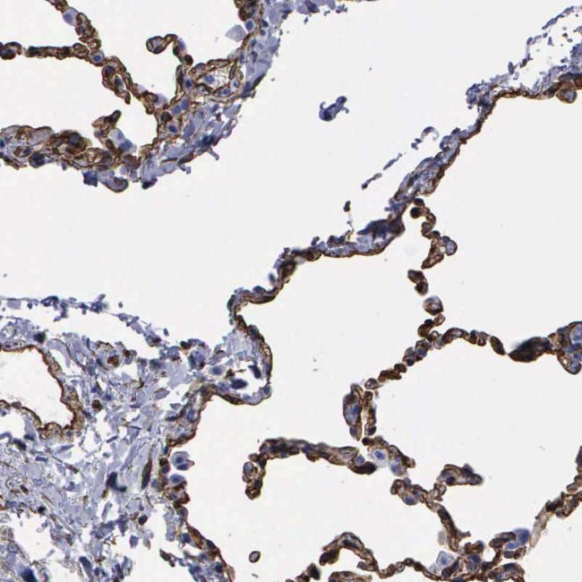 MAGEB10 Antibody in Immunohistochemistry (Paraffin) (IHC (P))
