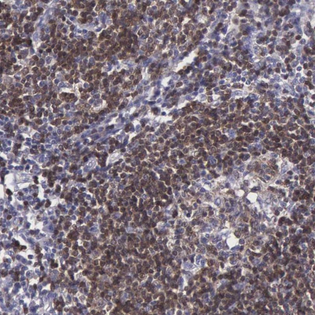 MICAL3 Antibody in Immunohistochemistry (IHC)