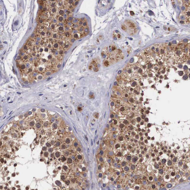 NAGA Antibody in Immunohistochemistry (Paraffin) (IHC (P))