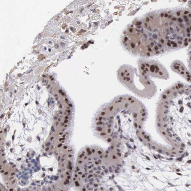 SLC25A21 Antibody in Immunohistochemistry (Paraffin) (IHC (P))