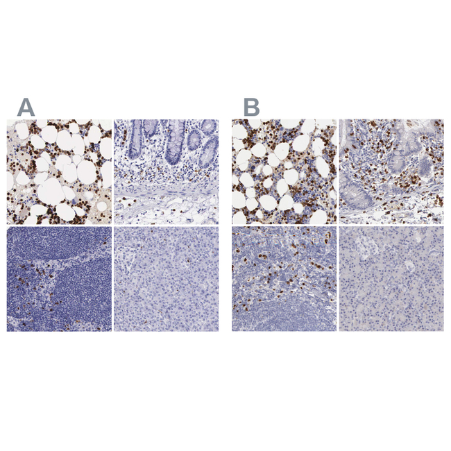 FCN1 Antibody in Immunohistochemistry (Paraffin) (IHC (P))