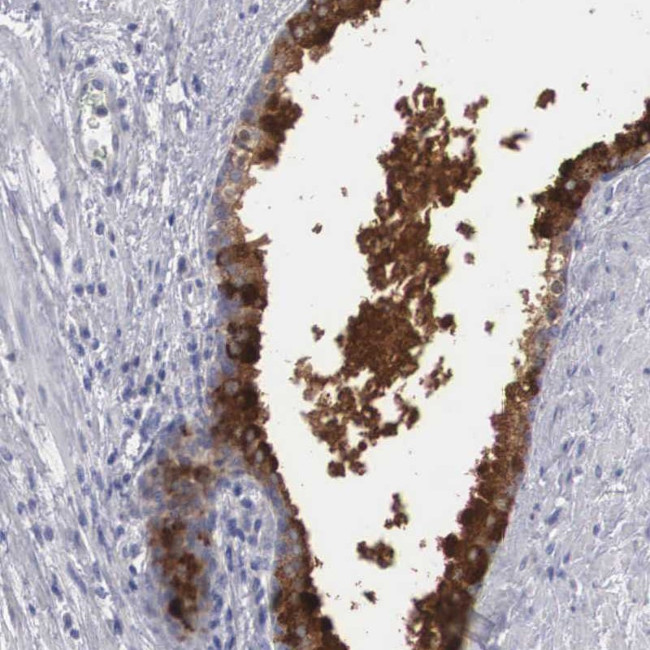 ZBTB42 Antibody in Immunohistochemistry (Paraffin) (IHC (P))