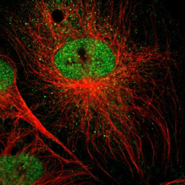 SPIN3 Antibody in Immunocytochemistry (ICC/IF)