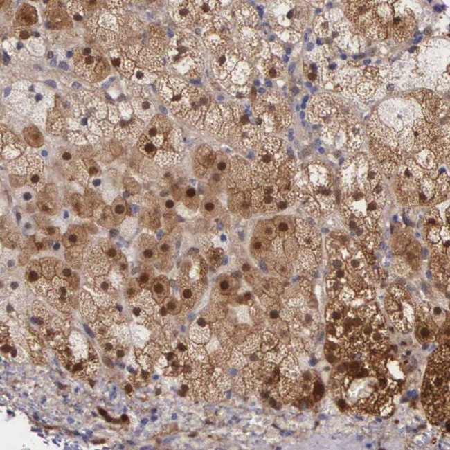 GSTT2B Antibody in Immunohistochemistry (IHC)