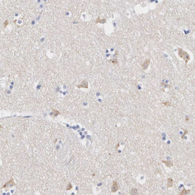 ASPHD2 Antibody in Immunohistochemistry (Paraffin) (IHC (P))