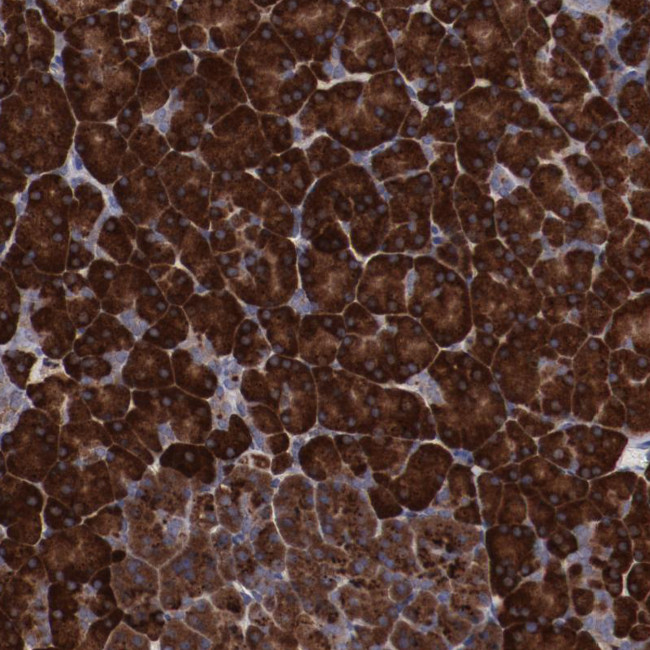 RPS4X Antibody in Immunohistochemistry (Paraffin) (IHC (P))